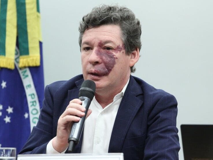 Deputado quer que regulamentação da reforma tributária passe pelo STF