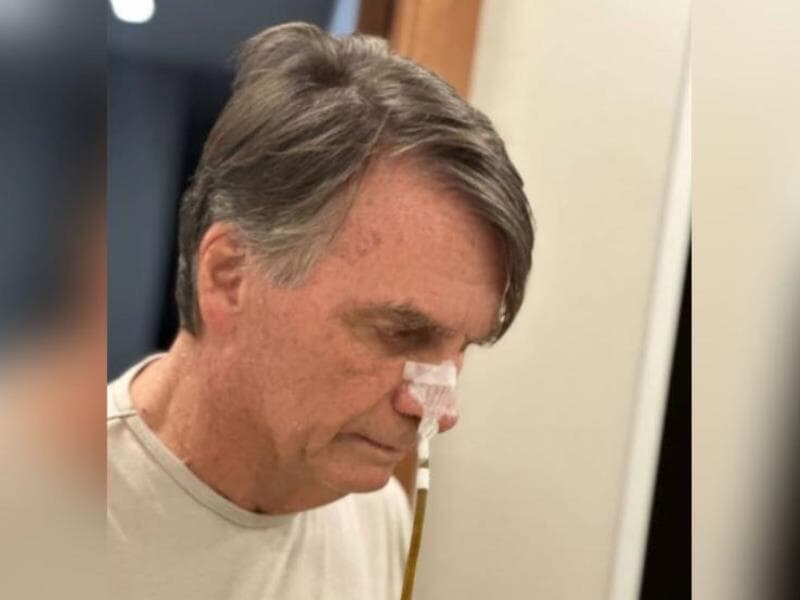 Bolsonaro no hospital, em imagem divulgada em perfil oficial de redes sociais. - Reprodução/Instagram (@jairmessiasbolsonaro)