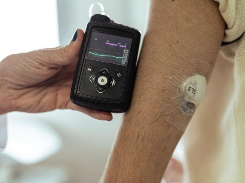 Projeto na Câmara busca assegurar, pelo SUS, o fornecimento de tecnologias no tratamento da diabetes tipo 1. - Lucas Seixas/Folhapress