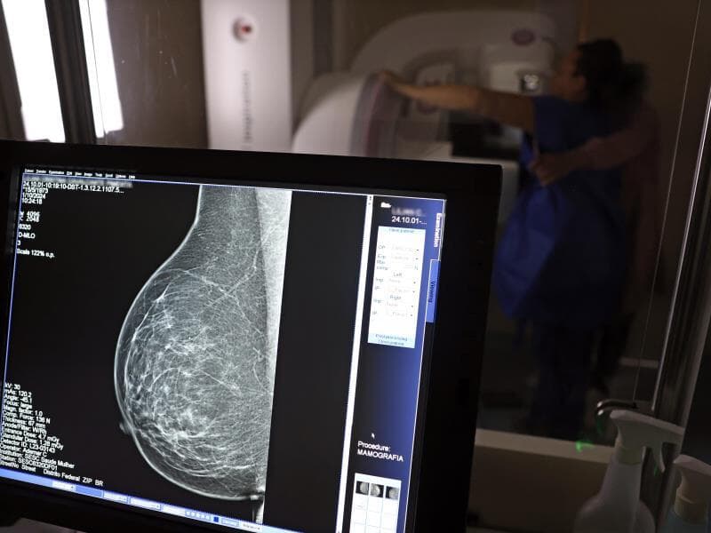 Teste de mamografia realizado na Campanha Outubro Rosa. - José Cruz/Agência Brasil