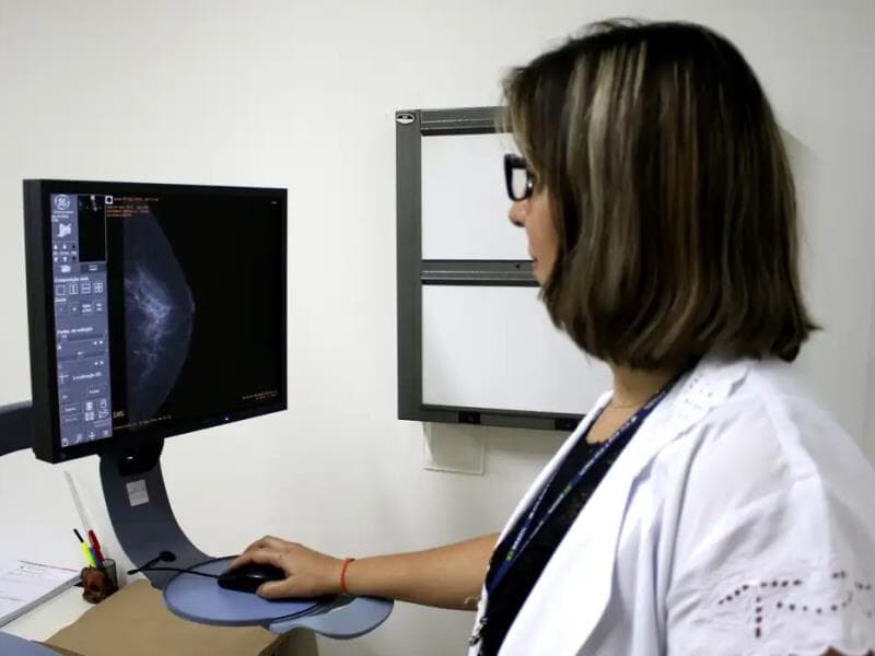 A proposta garante acesso anual gratuito ao exame a partir dos 40 anos. - Rodrigo Nunes/Ministério da Saúde