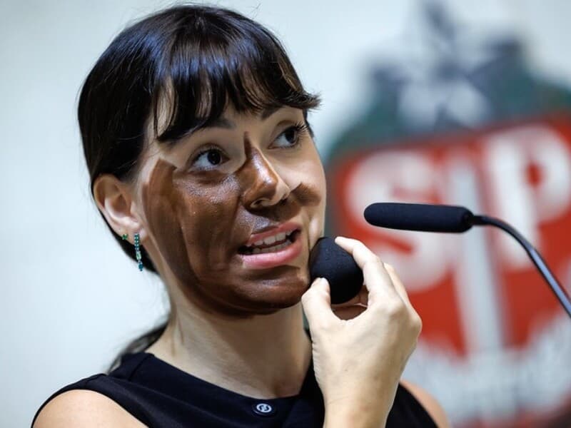 Fabiana Bolsonaro é acusada de discriminação racial e transfobia. - Rodrigo Costa/Alesp