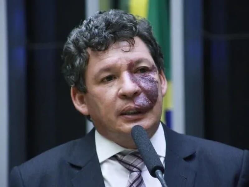 Reginaldo Lopes atua na comissão especial que discute o marco legal da inteligência artificial. - Paulo Sergio/Agência Câmara