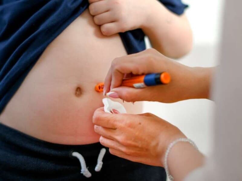 Projeto amplia acesso a tecnologias de ponta no tratamento do diabetes e pode reduzir judicialização na saúde pública. - Getty Images