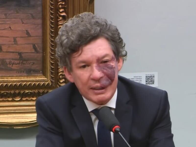 Autor da proposta defende celeridade para o tema no Senado, onde já existe matéria aprovada em comissão. - TV Câmara/Reprodução