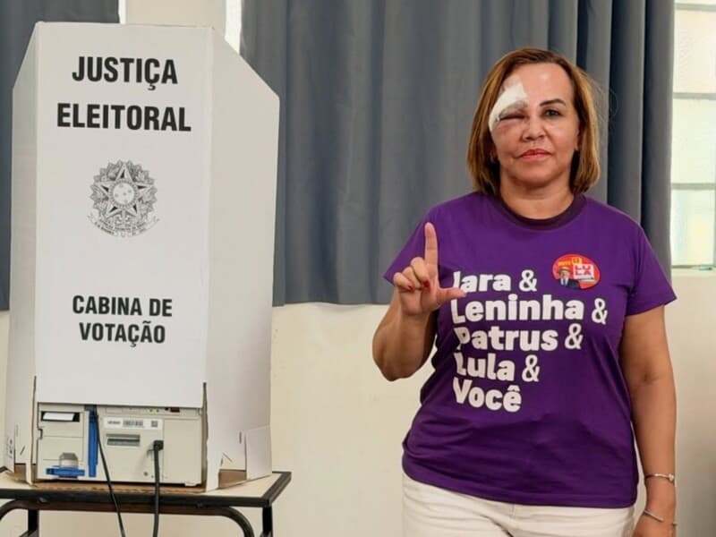 Iara Pimentel havia perdido a consciência ao ser apedrejada durante ato de apoio à campanha de Lula.
 - Divulgação/Instagram